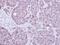 Replication Protein A1 antibody, NBP2-20206, Novus Biologicals, Immunohistochemistry frozen image 