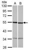 Tubulin Beta 1 Class VI antibody, GTX118928, GeneTex, Western Blot image 