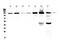 EPH Receptor A2 antibody, A00578, Boster Biological Technology, Western Blot image 