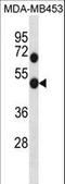 Rho GDP Dissociation Inhibitor Alpha antibody, LS-C157770, Lifespan Biosciences, Western Blot image 