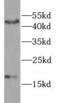 Gastric Inhibitory Polypeptide antibody, FNab09842, FineTest, Western Blot image 