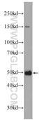 Malic Enzyme 2 antibody, 24944-1-AP, Proteintech Group, Western Blot image 