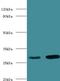 Carbonic Anhydrase 1 antibody, LS-C318509, Lifespan Biosciences, Western Blot image 