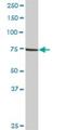 LIM Domain Kinase 2 antibody, H00003985-D01P, Novus Biologicals, Western Blot image 