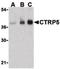 C1q And TNF Related 5 antibody, LS-B467, Lifespan Biosciences, Western Blot image 