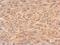 Rho GDP Dissociation Inhibitor Alpha antibody, NBP1-31528, Novus Biologicals, Immunohistochemistry paraffin image 