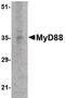 MYD88 Innate Immune Signal Transduction Adaptor antibody, MA5-15762, Invitrogen Antibodies, Western Blot image 