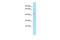 Exonuclease 5 antibody, A13188, Boster Biological Technology, Western Blot image 