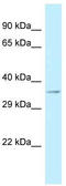 Cysteine Rich Secretory Protein LCCL Domain Containing 1 antibody, TA343241, Origene, Western Blot image 