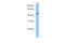 Zinc Finger And BTB Domain Containing 6 antibody, 25-453, ProSci, Enzyme Linked Immunosorbent Assay image 