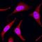 Mitogen-Activated Protein Kinase Kinase 3 antibody, MAB2515, R&D Systems, Immunofluorescence image 