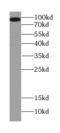 Post-GPI Attachment To Proteins 1 antibody, FNab06348, FineTest, Western Blot image 