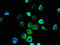 Zinc transporter ZIP11 antibody, orb356807, Biorbyt, Immunofluorescence image 