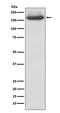 Neurofilament Medium antibody, M06821, Boster Biological Technology, Western Blot image 