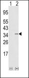 Snail Family Transcriptional Repressor 1 antibody, PA5-11923, Invitrogen Antibodies, Western Blot image 