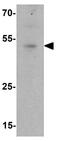 Interferon Induced Protein With Tetratricopeptide Repeats 1 antibody, GTX31570, GeneTex, Western Blot image 