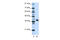 Heterogeneous nuclear ribonucleoprotein D-like antibody, ARP40585_T100, Aviva Systems Biology, Western Blot image 