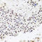 Ribonuclease P/MRP Subunit P30 antibody, A07553, Boster Biological Technology, Immunohistochemistry paraffin image 