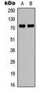 Raf-1 Proto-Oncogene, Serine/Threonine Kinase antibody, LS-C368525, Lifespan Biosciences, Western Blot image 