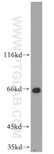 Zinc Finger Protein 34 antibody, 20477-1-AP, Proteintech Group, Western Blot image 