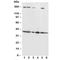 Fas Ligand antibody, R30267, NSJ Bioreagents, Western Blot image 