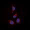 Signal Transducing Adaptor Molecule 2 antibody, orb315715, Biorbyt, Immunocytochemistry image 