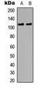 Catenin Delta 1 antibody, LS-C358960, Lifespan Biosciences, Western Blot image 