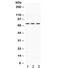 Interleukin 2 Receptor Subunit Beta antibody, R31980, NSJ Bioreagents, Western Blot image 