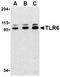 Toll-like receptor 6 antibody, TA306272, Origene, Western Blot image 