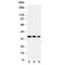 Homeobox A4 antibody, R30682, NSJ Bioreagents, Western Blot image 
