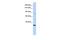 AHNAK Nucleoprotein 2 antibody, PA5-42242, Invitrogen Antibodies, Western Blot image 