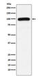 Ubiquitin Protein Ligase E3A antibody, M00582, Boster Biological Technology, Western Blot image 