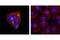 ATP Binding Cassette Subfamily C Member 2 antibody, 4446S, Cell Signaling Technology, Immunofluorescence image 