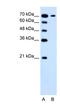 Low affinity sodium-glucose cotransporter antibody, NBP1-59886, Novus Biologicals, Western Blot image 