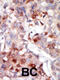 AKT Serine/Threonine Kinase 3 antibody, A00520-1, Boster Biological Technology, Immunohistochemistry paraffin image 