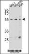 Zinc Finger Protein 117 antibody, 56-484, ProSci, Western Blot image 