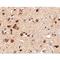 Serine/Threonine Kinase 39 antibody, LS-C82871, Lifespan Biosciences, Immunohistochemistry paraffin image 