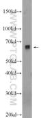 Phosphatidylinositol Glycan Anchor Biosynthesis Class S antibody, 18334-1-AP, Proteintech Group, Western Blot image 