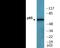 p65 antibody, EKC2476, Boster Biological Technology, Western Blot image 