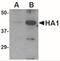 Avian Influenza Hemagglutinin 1 antibody, NBP2-41051, Novus Biologicals, Western Blot image 