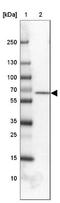 Transmembrane Channel Like 4 antibody, NBP2-13437, Novus Biologicals, Western Blot image 