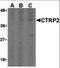 C1q And TNF Related 2 antibody, orb86699, Biorbyt, Western Blot image 