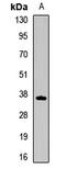 Testis Specific Serine Kinase 4 antibody, LS-C668642, Lifespan Biosciences, Western Blot image 