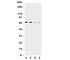 High affinity cationic amino acid transporter 1 antibody, R31369, NSJ Bioreagents, Western Blot image 