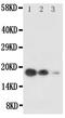 KIT Ligand antibody, PA1565, Boster Biological Technology, Western Blot image 