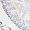 Heterogeneous Nuclear Ribonucleoprotein U antibody, GTX66039, GeneTex, Immunohistochemistry paraffin image 