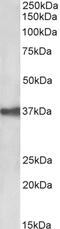Peripherin antibody, 43-544, ProSci, Western Blot image 