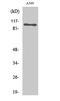 ATPase Na+/K+ Transporting Subunit Alpha 1 antibody, STJ94336, St John