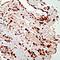 Platelet Derived Growth Factor Receptor Alpha antibody, GTX15501, GeneTex, Immunohistochemistry paraffin image 