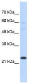 TATA-Box Binding Protein Associated Factor 12 antibody, TA330160, Origene, Western Blot image 